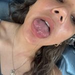 Kenzie Mirelles - ⭐ Yngleaks.com X