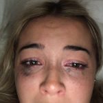 Livvy Dunne - Image 319