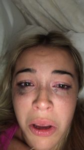 Livvy Dunne - Image 319