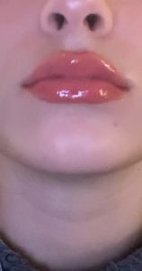IMG_5930