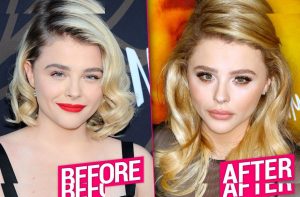 Chloë Grace Moretz - Image 192